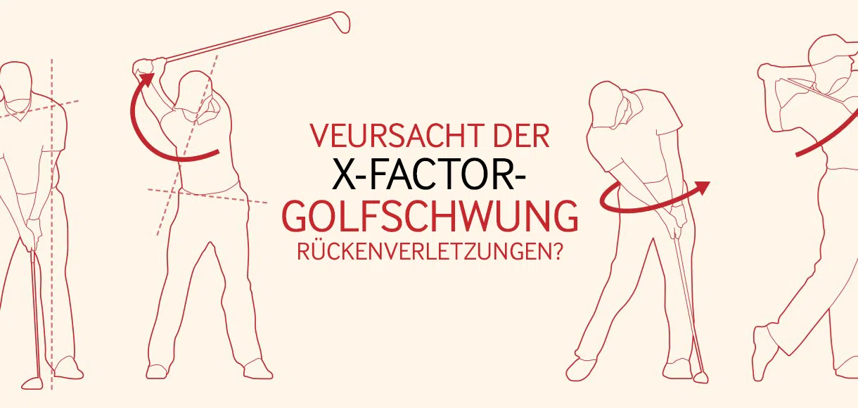 Verursacht der X-Factor beim Golfschwung Rückenverletzungen?